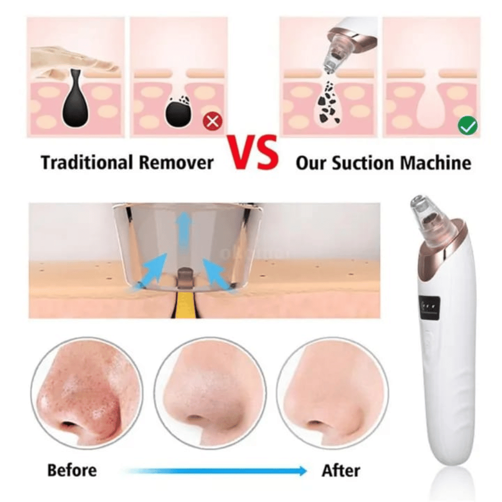 Face Vacuum Blackhead Remover Pore Cleaner Electric Deep Cleansing Tool For Nose And Face