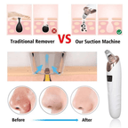 Face Vacuum Blackhead Remover Pore Cleaner Electric Deep Cleansing Tool For Nose And Face